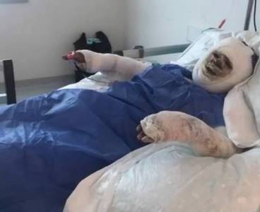 Eski damat kaynanasını benzin dökerek yaktı