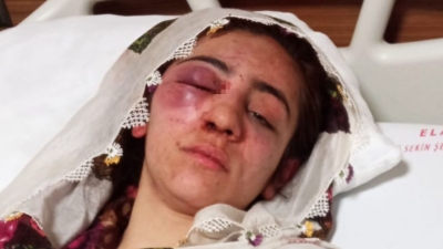 4 aydır kaçtığı adamdan haber yok, kendisini ailesi öldüresiye darp etti.